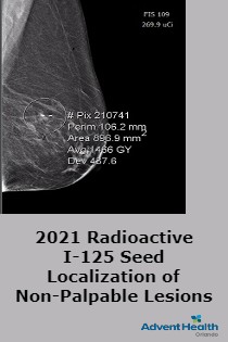 2021 Radioactive I-125 Seed Localization of Non-Palpable Lesions Banner